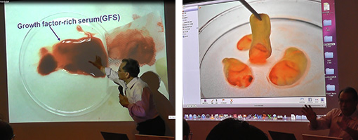 講演:台湾陽明大学歯科系血液再生臨床応用講座  蘇 正堯 先生